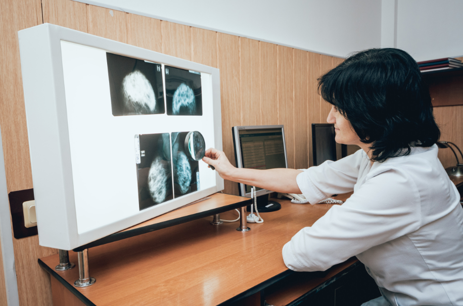 Efeito dos programas de rastreamento mamográfico