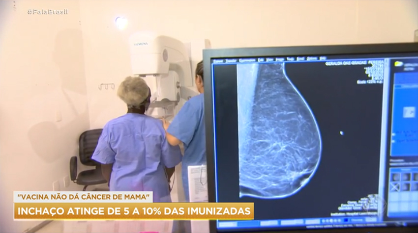 Inchaço nas glândulas após vacinação pode alterar exame de mamografia